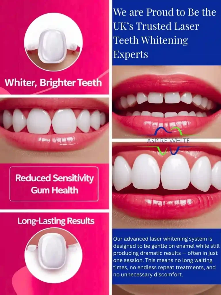 We are Proud to Be the UK’s Trusted Laser Teeth Whitening Experts Rotherham